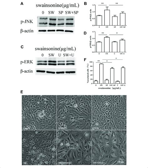 | Effects of MAPK pathway inhibitors on SW-induced cytoplasmic ...