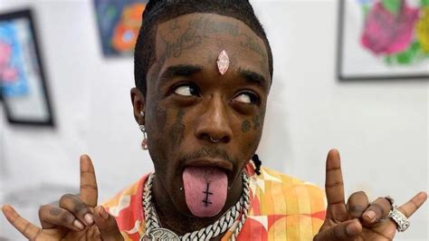 Lil Uzi Vert Appears to Have Re-Implanted His $24 Million Forehead Diamond