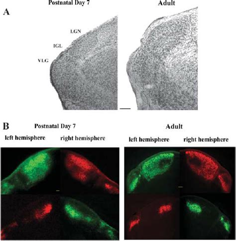 Anatomical organization of the lateral geniculate nucleus ~ LGN ! in ...