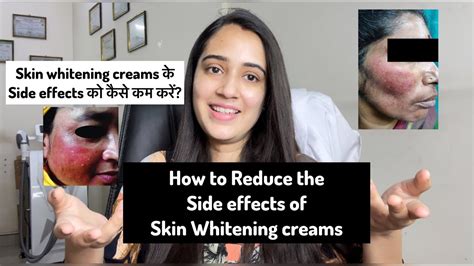 Skin whitening creams side effects | How to reduce side effects ...