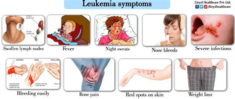 Leukemia-symptoms - Alicia Llanas