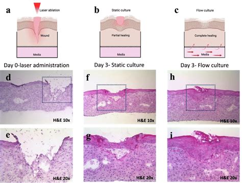 Faster wound healing in flow culture ( a, b, c) Pictorial... | Download ...