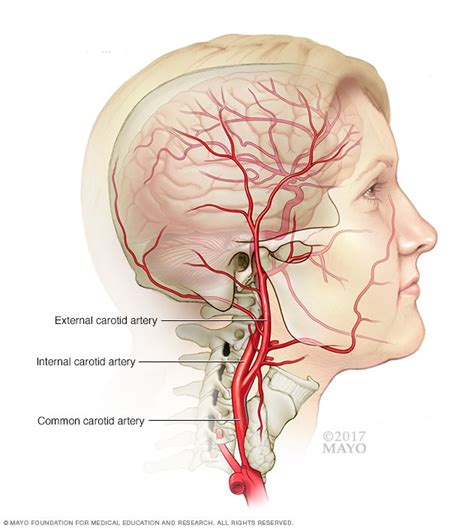 Carotid ultrasound - Mayo Clinic