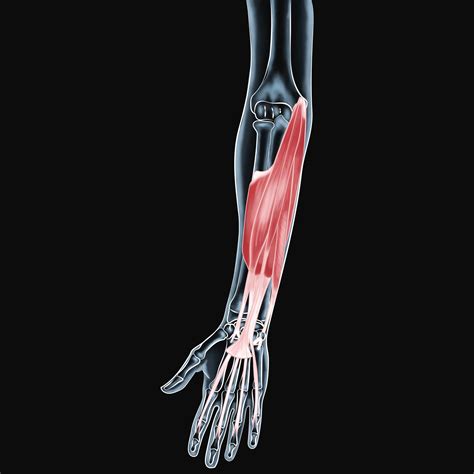 Strengthening Recovery - Treating Wrist Flexor Muscle Injuries