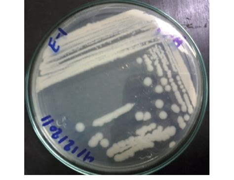 Bacillus Cereus Colony Morphology