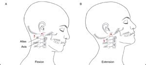 What is the Normal Range of Motion of the Neck? - NeckCheckUp