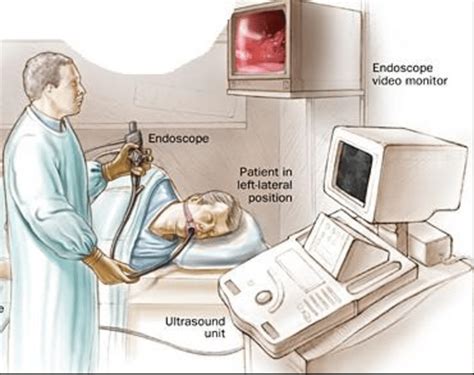 Endoscopic Retrograde Cholangiopancreatography Market Growth and ...