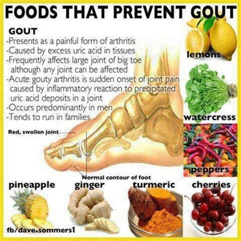 Occurence and prevention of gout: what foods to avoid and which foods ...