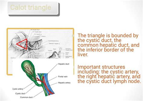 Calot Triangle - MEDizzy