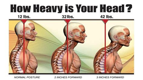 Poor Posture Treatment - Snyder Chiropractic & Wellness