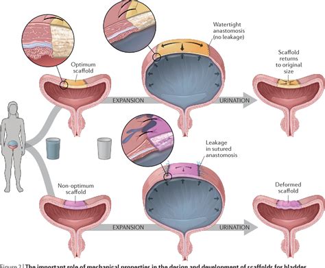 Bladder biomechanics and the use of scaffolds for regenerative medicine ...