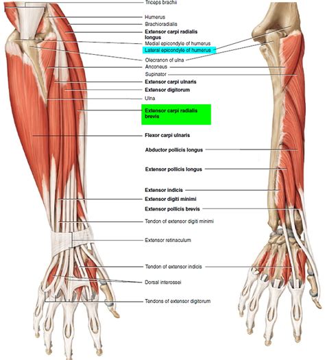 [DIAGRAM] Arm Tendons Diagram - MYDIAGRAM.ONLINE