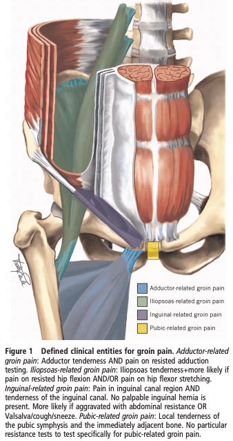 How To Manage A Hip Flexor Strain How To Manage A Hip Flexor Strain