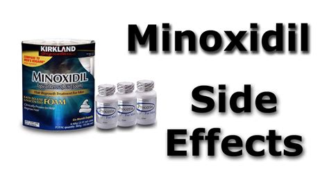 Poyzunivy Style: Side Effects Of Minoxidil Hair Treatment