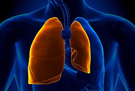 Pneumothorax (Collapsed Lung): Causes & How to Treat It