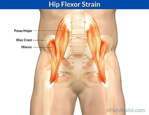 Hip Flexor Stretch: Hip flexor strain is also called as psoas strain ...