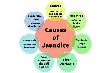 Kramer Jaundice Chart