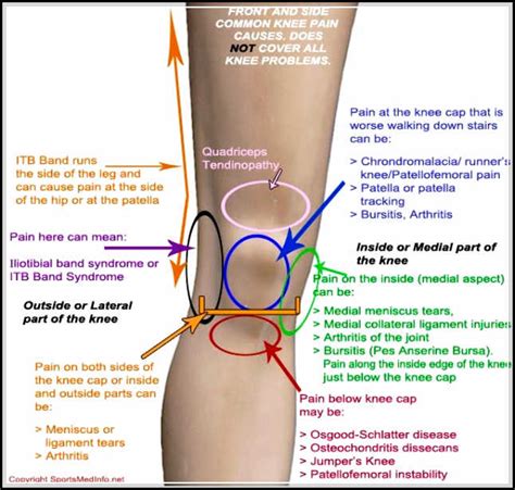 Knee Pain Causes You Should Know and Avoid - Your friendly fashion blog ...