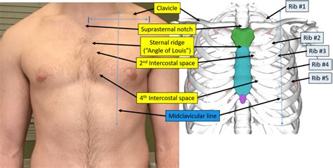 Proper Electrocardiogram (ECG/EKG) Lead Placement | ECGEDU