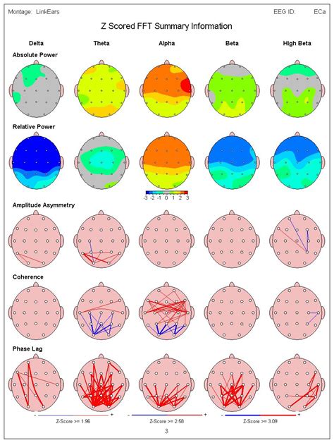 Example Neuroguide Image | Brain mapping, Brain, Map