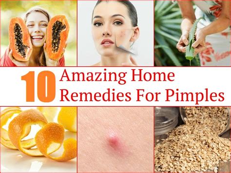 10 Amazing Home Remedies For Pimples - School Of Life