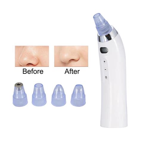 Skin Care Pore Vacuum Blackhead Remover Acne Pimple Removal Vacuum ...