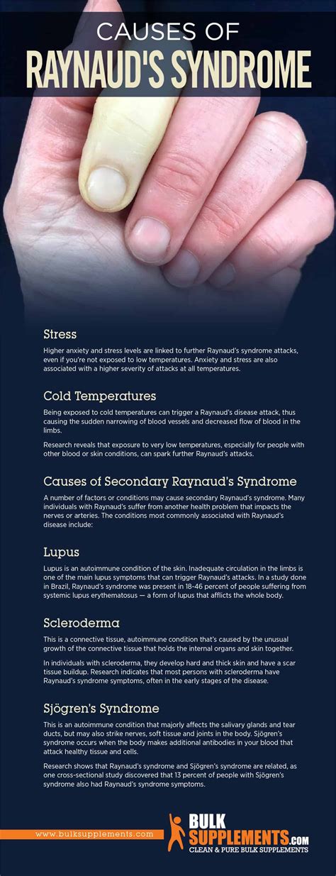 Raynaud's Syndrome: Symptoms, Causes & Treatment