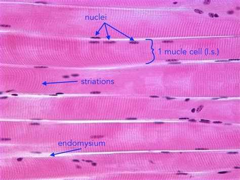 Histology - Skeletal Muscle Cells (l.s.) | Skeletal muscle, Human ...