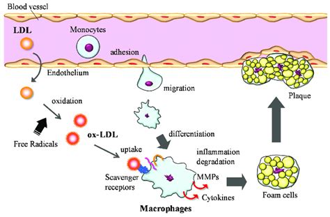 Atherosclerosis Mechanism