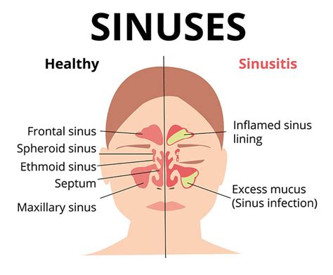 What Causes Swollen Nasal Passages