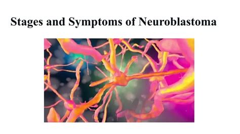 PPT - Stages and Symptoms of Neuroblastoma PowerPoint Presentation ...