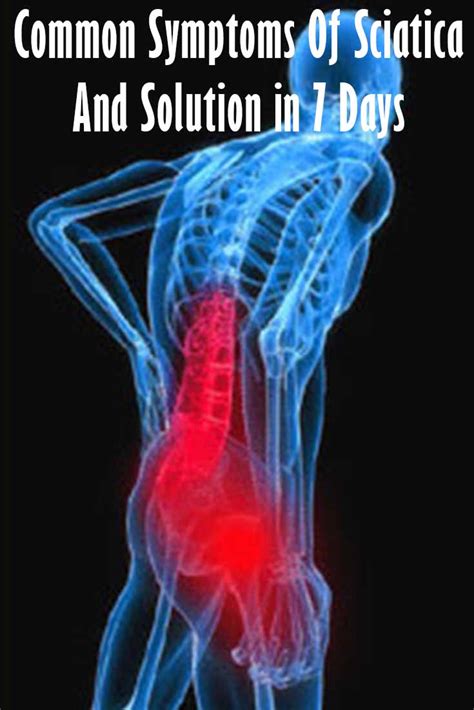 Proven Exercises and Treatment to help remedy sciatica in 7 Days ...