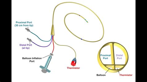 Swan Ganz Catheter Placement