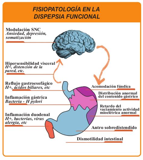 DISPEPSIA, SÍNTOMA DE SÍNTOMAS – BOTICA DIGITAL MEDICAL MAGAZINE