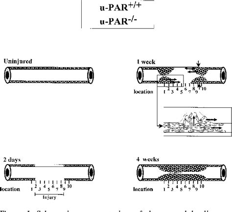 Figure 1 from Receptor-independent Role of Urokinase-Type Plasminogen ...