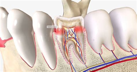 Sensitive Teeth is a Common Dental Condition Characterized by Sharp ...