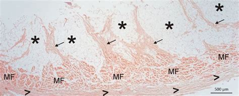 Human Frontalis Muscle Innervation and Morphology : Plastic and ...