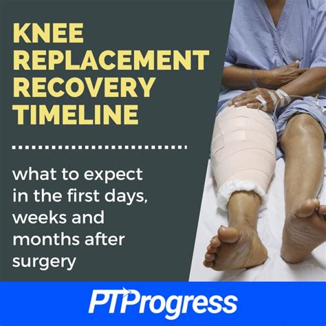 Knee Replacement Recovery Timeline: What to Expect