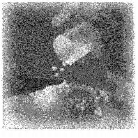 Depakote Sprinkle Capsules (Abbott), Drug Reference Encyclopedia