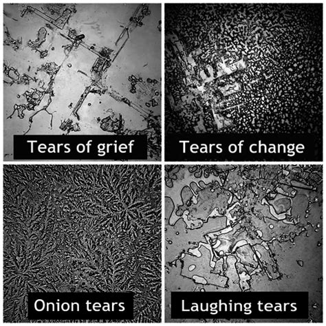 Human Tears under a microscope : r/pics