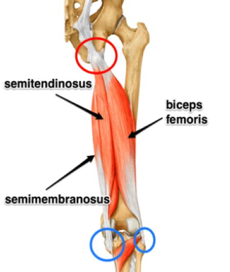 Hamstring Tendonitis (or is it Hamstring Syndrome?) | Zion Physical Therapy