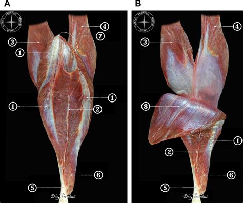 Anatomy of the Triceps Surae - Foot and Ankle Clinics