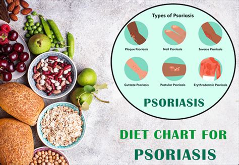 Diet Chart For Psoriasis - Food to Take / Food to Avoid