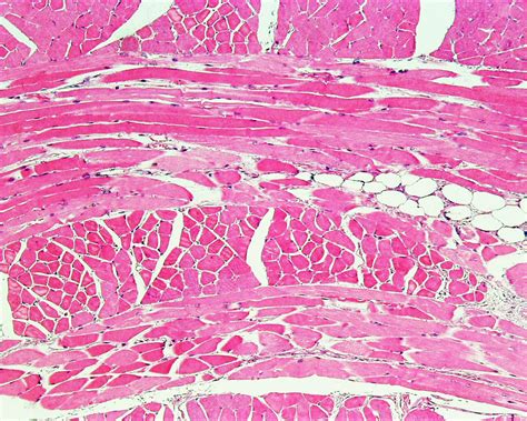 Skeletal Muscle Tissue Histology