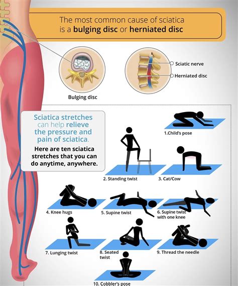 slip disc l5 s1 exercises - Virginia Scott