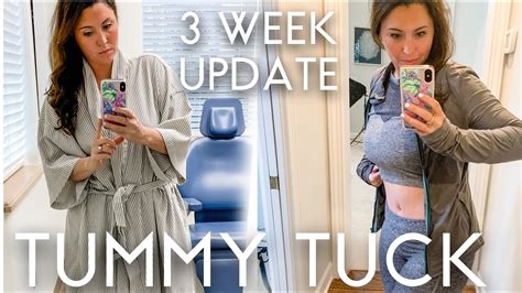 Postpartum tummy tuck before and after - diyGros