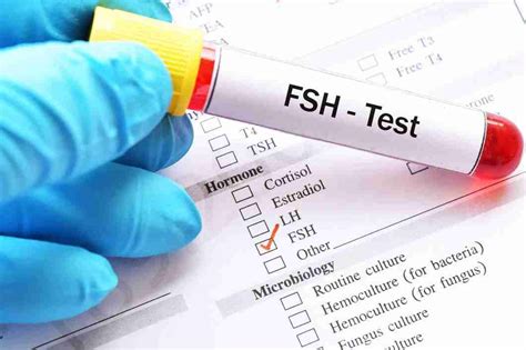 FSH Test: Purpose, Procedure, Risks, & Understanding Reports