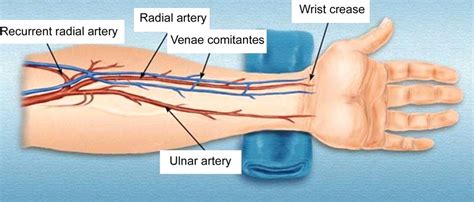 Radial artery gross anatomy | Gross anatomy, Phlebotomy, Arteries