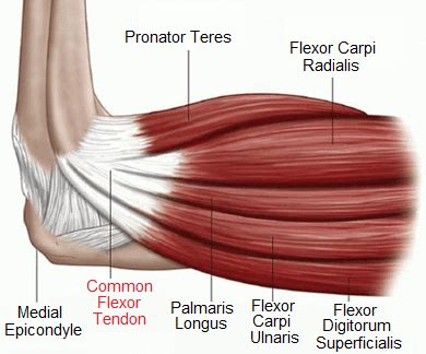 Forearm Tendonitis: Symptoms, Causes & Treatment