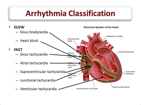 Pediatric Arrhythmia Management Services in Narayan Peth, Pune, Little ...